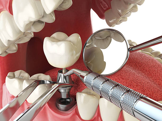 Best Root Canal Emergency Dentist  in San Andreas, CA